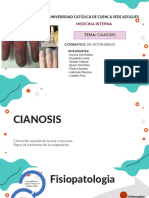 Cianosis Med Interna