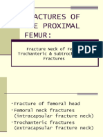 Proximal Femur Fractures: Neck, Trochanteric & Subtrochanteric Injuries