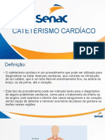 Cateterismo, angioplastia e CDI