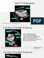 Cardiac CT Anatomy