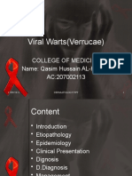Viral Warts (Verrucae) : College of Medicine Name: Qasim Hussain AL-Haleimi AC:207002113