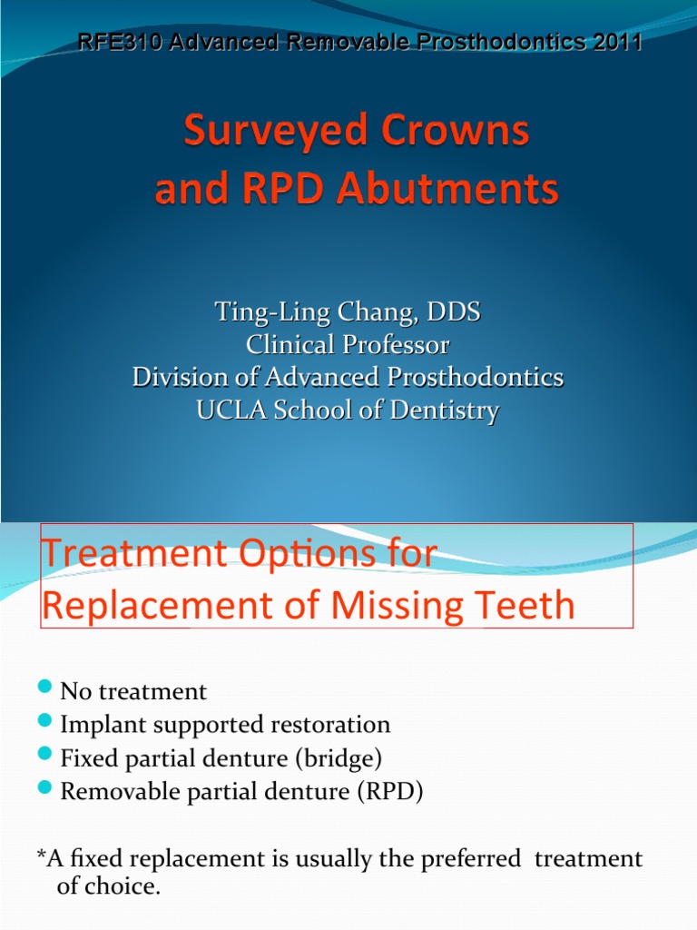 Surveyed Crowns in RPD Design | PDF | Dentures | Dentistry