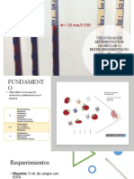 Velocidad de Sedimentacion Globular o Eritrosedimentacion