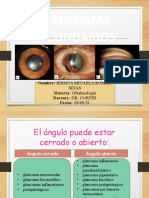 Glaucomas Secundarios: Nombre: Jessica Micaela Román Materia: Oftalmología Docente: DR. CORTÉS Fecha: 29/09/21