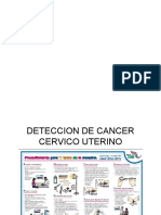 cancer cervico