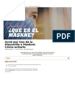 Maskné_ el Nuevo Acné producido por la Mascarilla