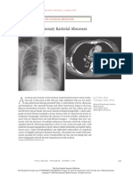 Chen, J.-Y., & Li, Y.-H. (2006) - Multiple Pulmonary Bacterial Abscesses. New England Journal of Medicine, 355 (25), E27