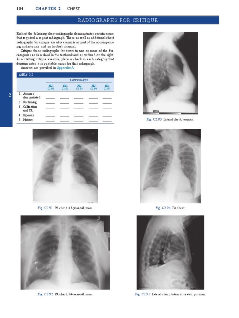 BONTRAGER RADIOGRAPHIC POSITIONING AND RELATED ANATOMY PDF intelligence overview