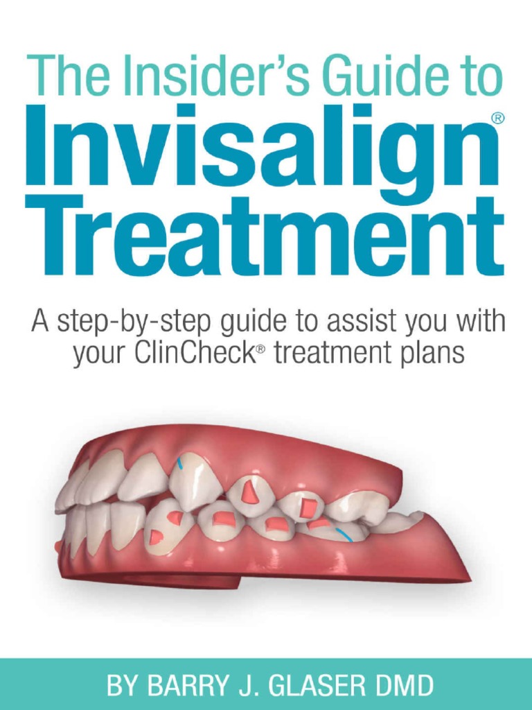 The Insider's Guide To Invisalign Treatment - A Step-By-step Guide To ...
