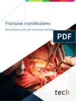 Fracturas Mandibulares