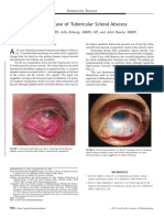 A Rare Case of Tubercular Scleral Abscess.14