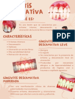 Gingivitis Descamativa