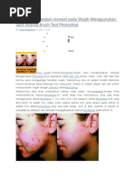Download Cara Menghilangkan Jerawat Pada Wajah Menggunakan Spot Healing Brush Tool Photoshop by Muinkbl Hamran SN55980377 doc pdf