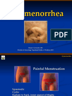 Dysmenorrhea 30-03-2008