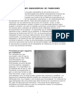 Indicaciones Radiograficas de Fundiciones