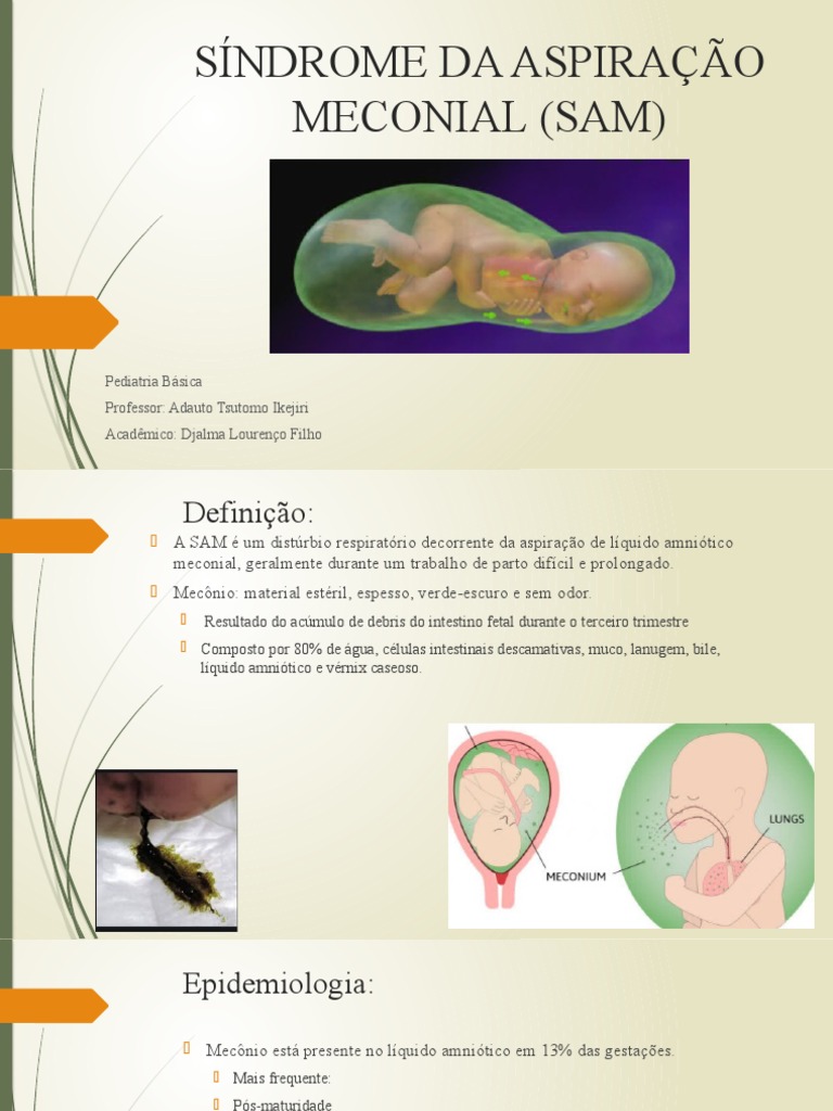 Síndrome Da Aspiração Meconial (Sam) | PDF | Medicina Clínica | Fisiologia