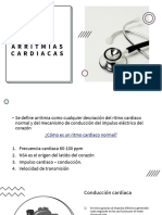 Arritmias cardiacas: tipos, causas y tratamiento