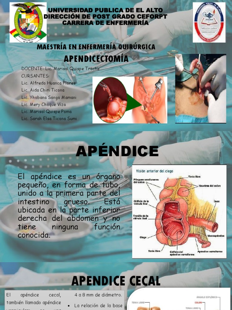 Técnicas de Apendicectomía y Anatomía | PDF | Especialidades Medicas ...