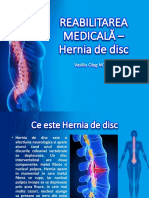 Hernia de Disc