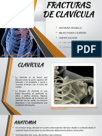 Fracturas de Clavicula