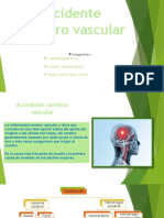 ACV: Accidente cerebrovascular