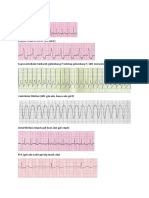 EKG Jantung