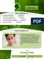 VARICELLA