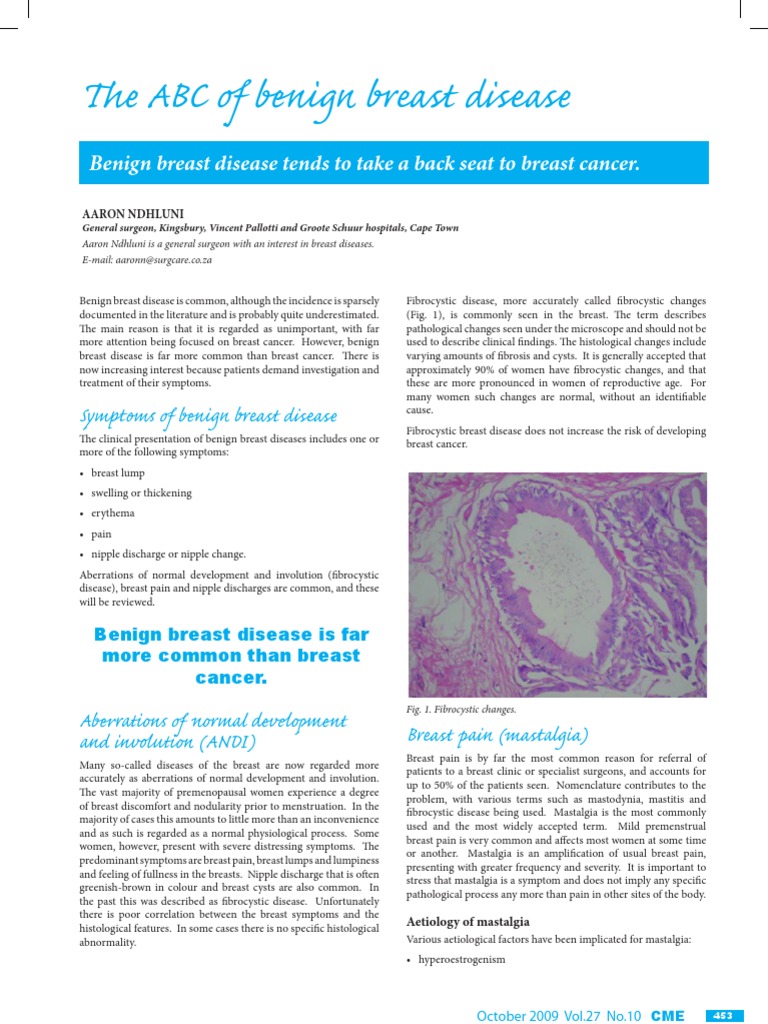 ABC of Benign Breast Disease | PDF