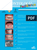 Uso de Endopostes de Ionómero de Vidrio en Odontopediatría