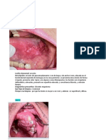 Lesiones