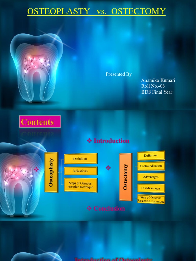 Osteoplasty vs. Ostectomy: Presented by Anamika Kumari Roll No.-08 BDS ...