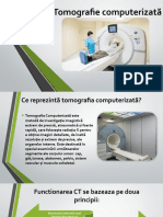 Tomografie computerizată