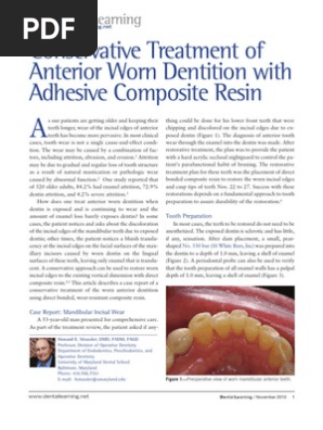 Conservative Treatment of Anterior Worn Dentition With Adhesive Composite Resin