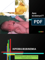 HIPERBILIRUBINEMIA New