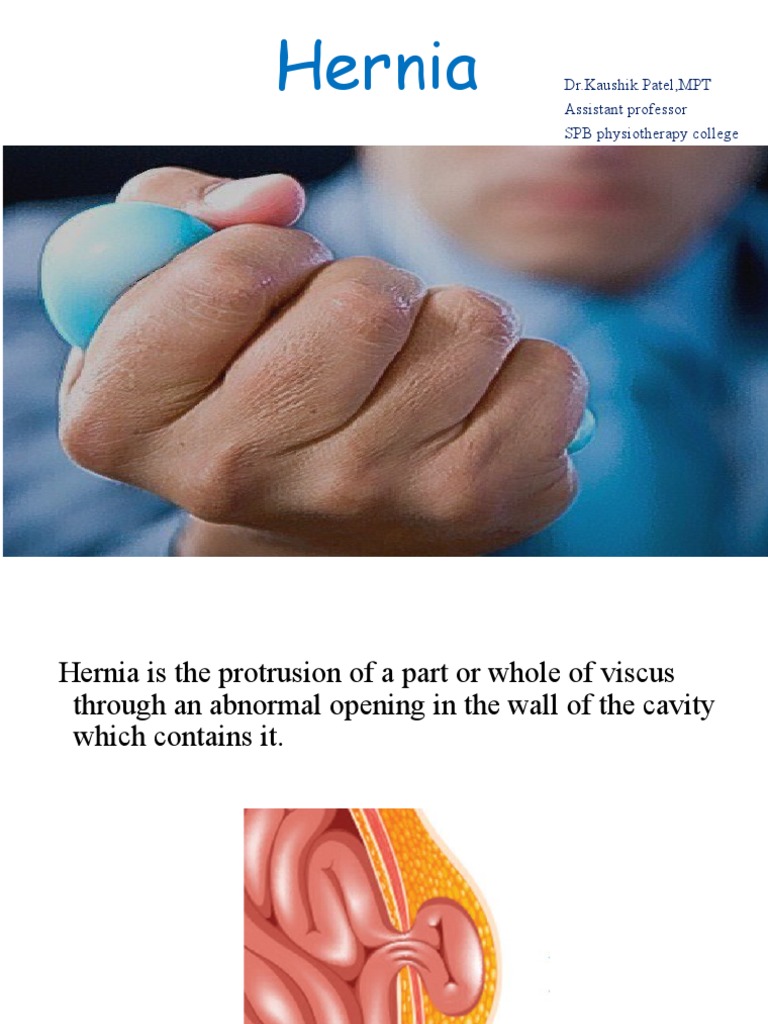 Pyriform Shape in Indirect Hernia | PDF | Medical Specialties ...