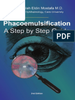 Phacoemulsification A Step by Step Guide
