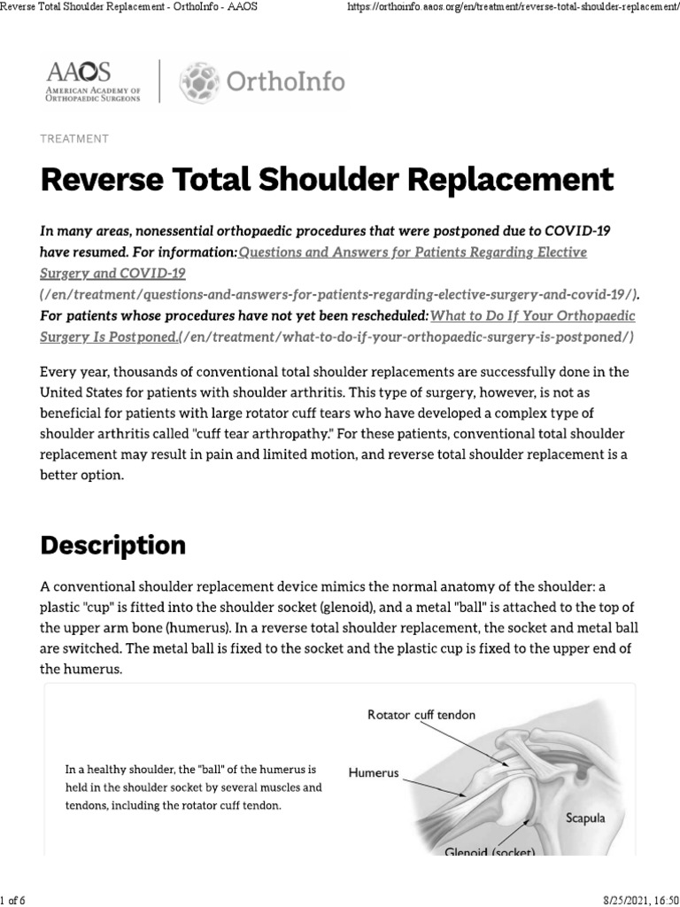 Reverse Total Shoulder Replacement OrthoInfo AAOS PDF