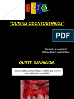 Quistes Odontogenicos