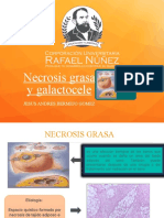 Necrosis Grasa Y Galactocele