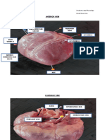 Anterior View: Barrion, Galenn Jewel Ann G. Anatomy and Physiology N1B Heart Dissection
