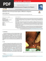 Pilonidal Sinus