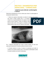 AP1 - 5 Herramientas Subjetivas para Detectar Cardiomegalia