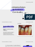 Restauraciones de Lesiones Cervicales