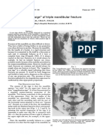 Signos Radiograficos de Fracturas Mandibulares