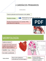 Tumores Cardiacos Primarios