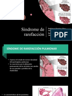 Síndrome de rarefacción pulmonar