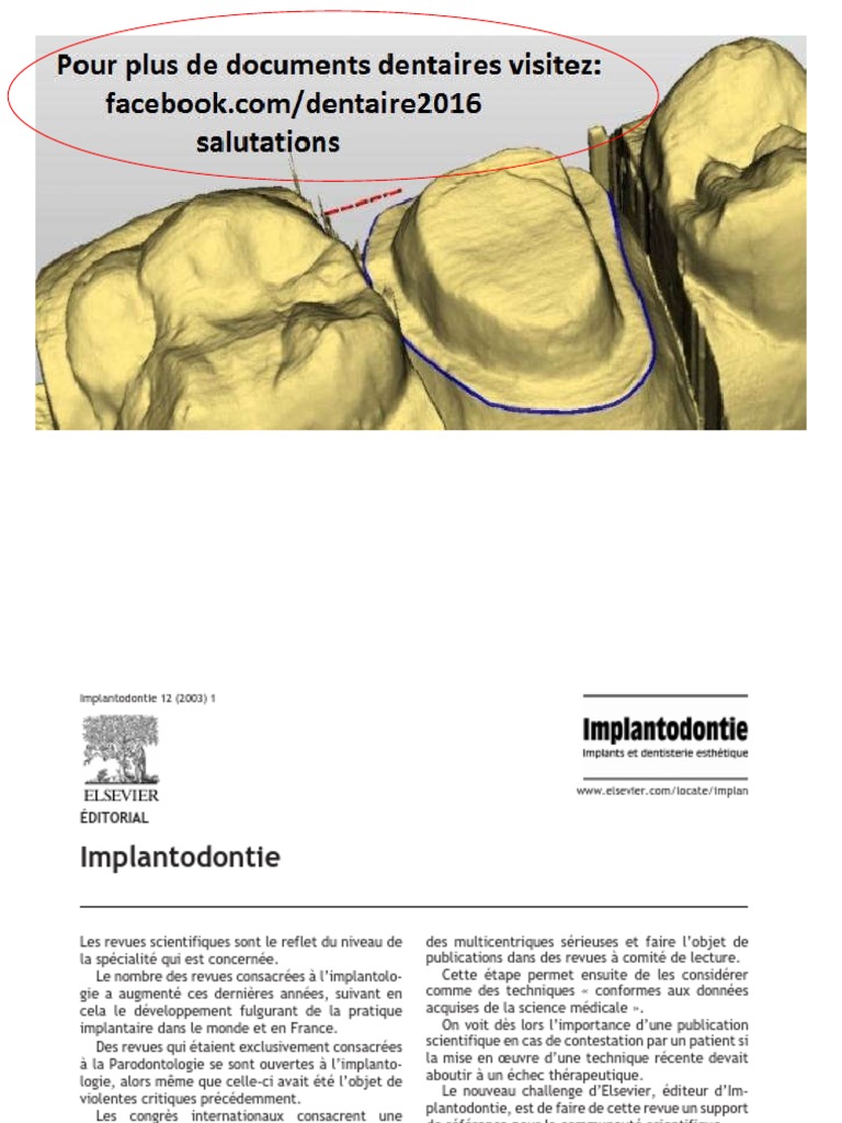 Nettoyeur UV à ultrasons pour prothèses dentaires, gouttière, dispo