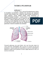 Cancerul pulmonar