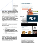 Resumen Estenosis Aortica - SEMIOLOGIA Argente