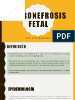 Hidronefrosis Fetal: Urología Pediátrica